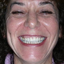 Woman with birlliant white smile